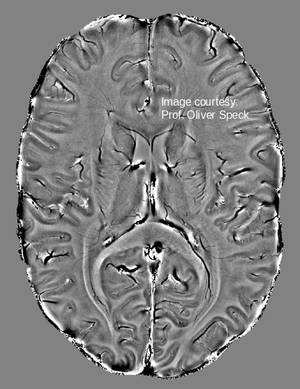 Horizontal brain slice imaged at 7T.