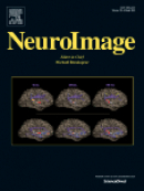 Article by researchers, including DRCMR people, published in NeuroImage