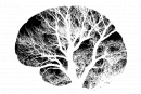2013: Multimodal Brain Imaging