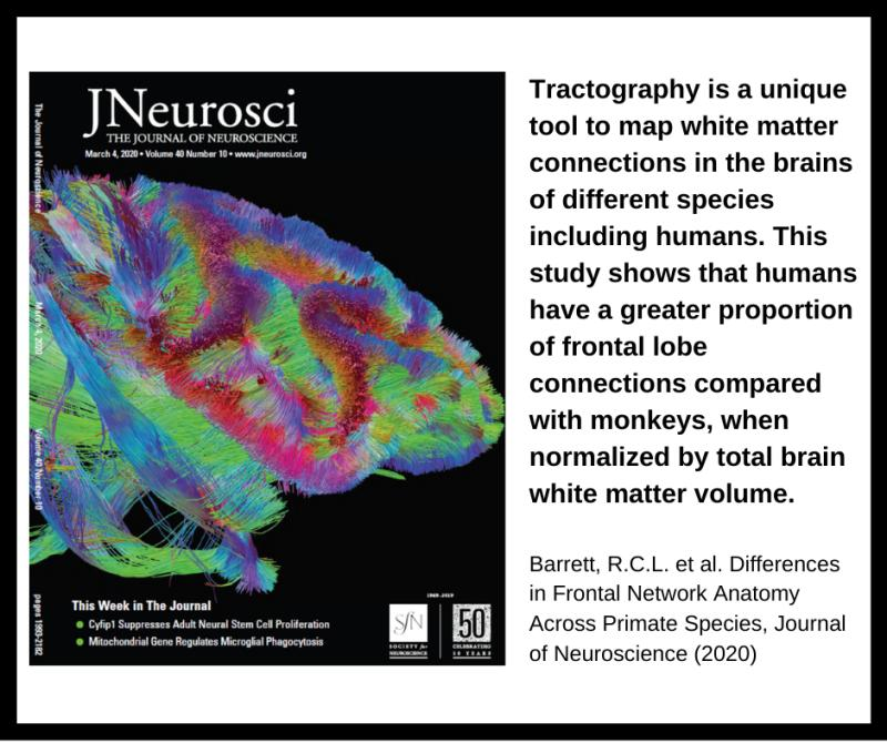 050320 Tim Dyrby i Journal of Neuroscience