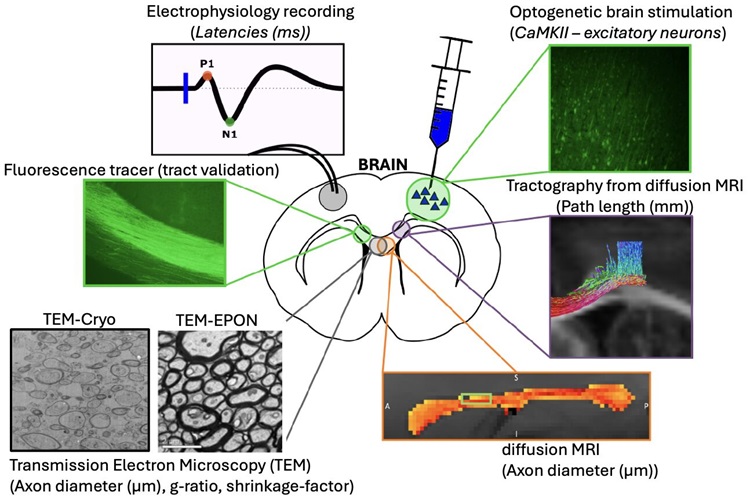 09022026 How fast does information travel in the brain 750x499