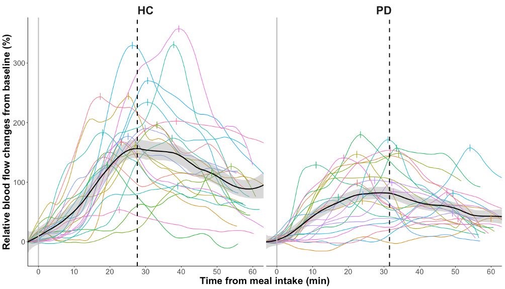 190121 DRCMR i Journal of Parkinsons Disease