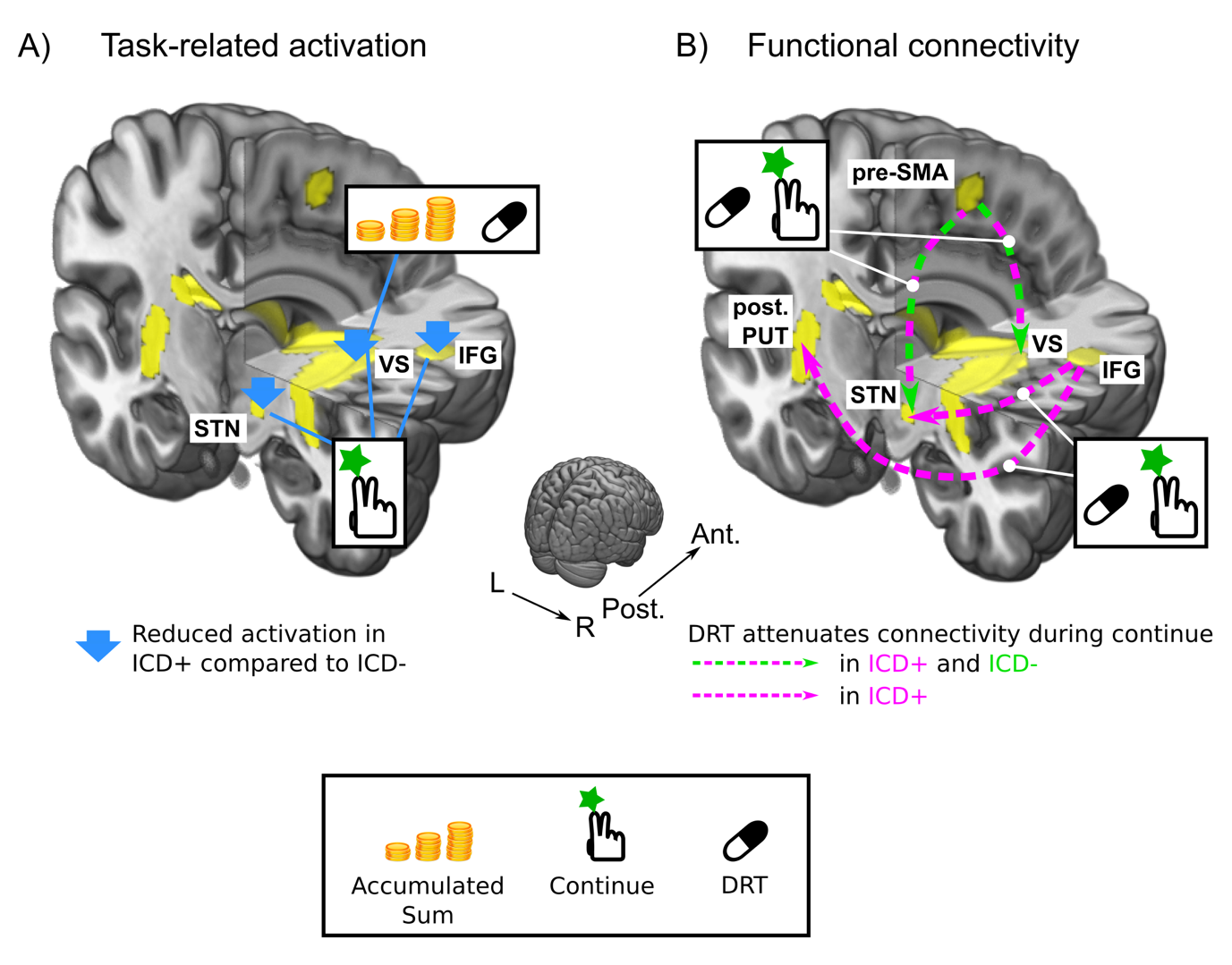 31072020 Movement disorders group article