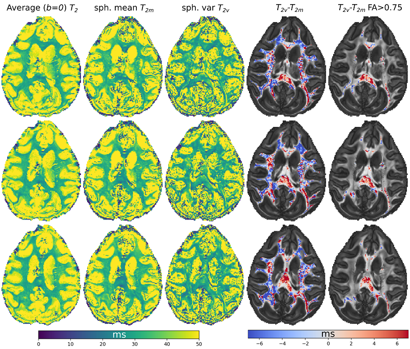 Axon Relaxation Dataset billede 1 800x682