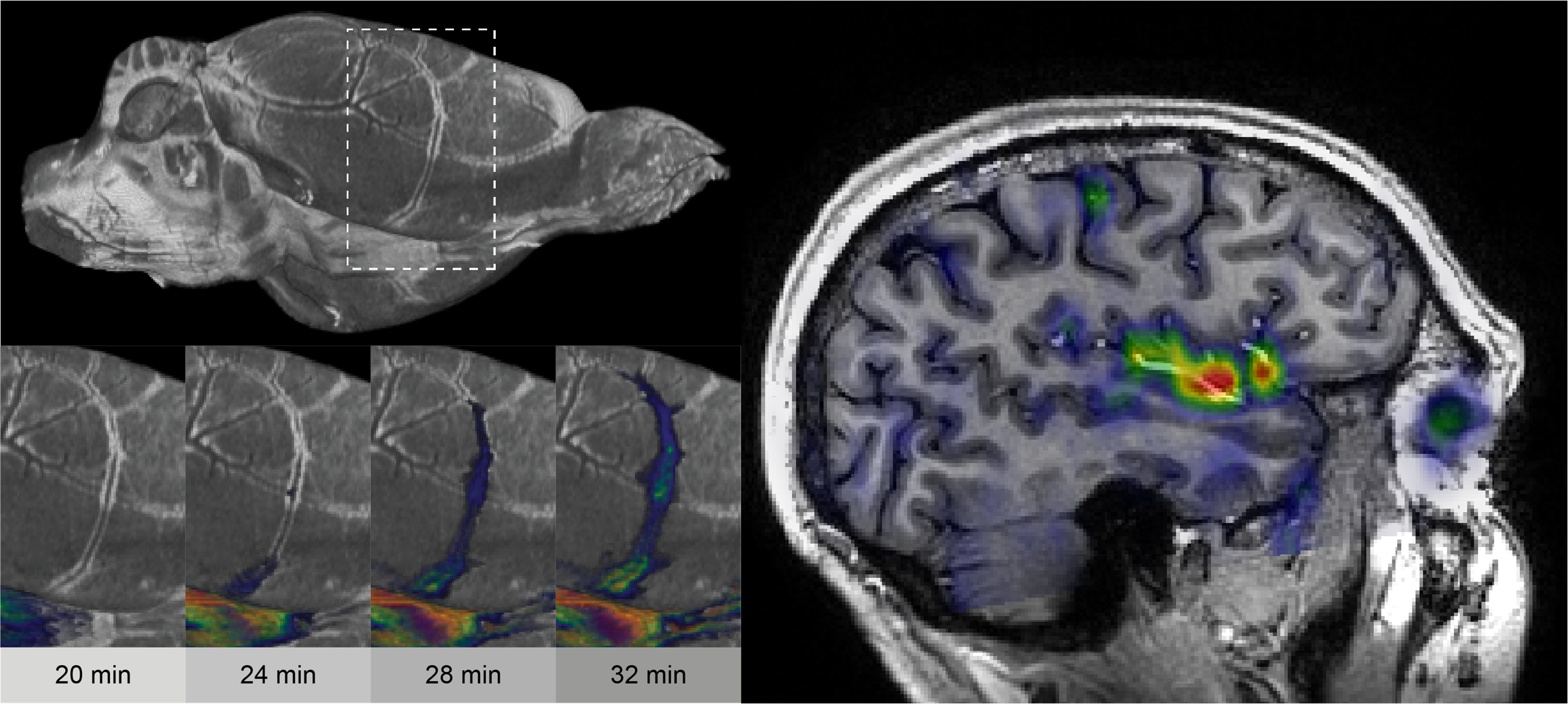 Neurofluids Billede1