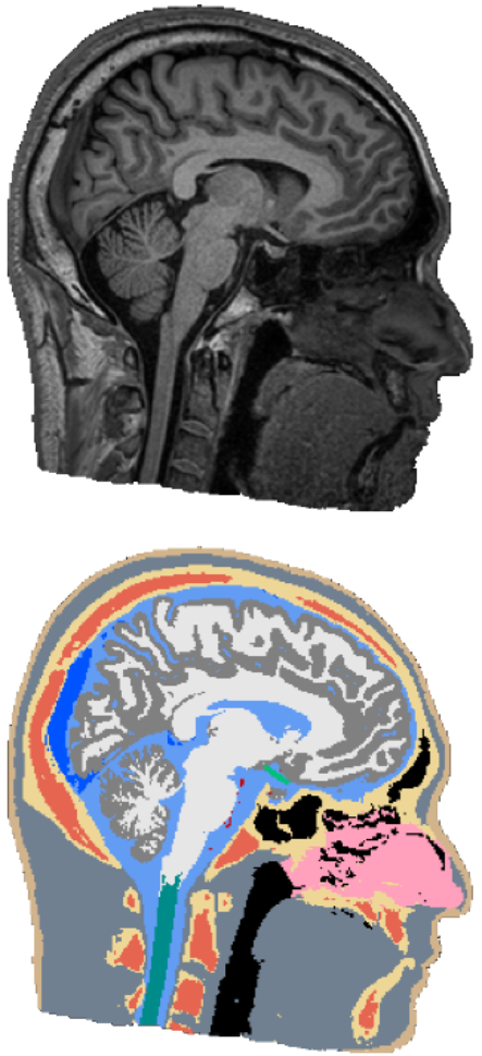 Neurophysics Figure 2