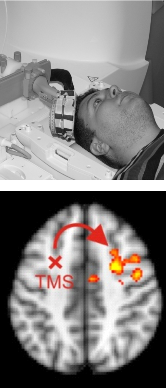 Neurophysics Figure 6