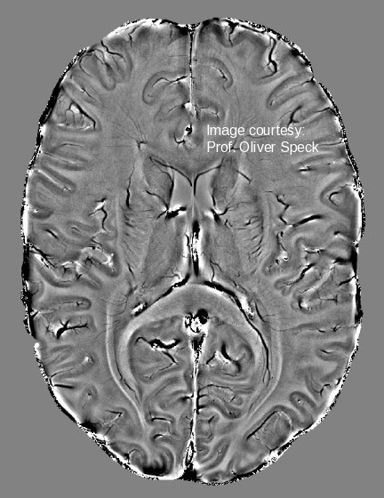 Horizontal brain slice imaged at 7T. Horizontal brain slice imaged at 7T.
