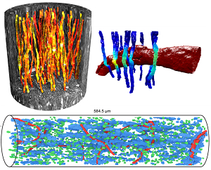 Do you want to know what white matter looks like in 3D?