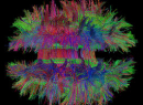 2019: PhD Course in Foundational skills for Neuroimaging. Postponed! Start date is to be announced
