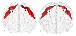 The creative brain of the left-handed