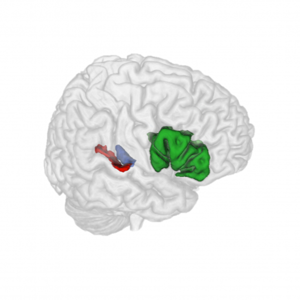 Decoding sounds from human brain activity patterns